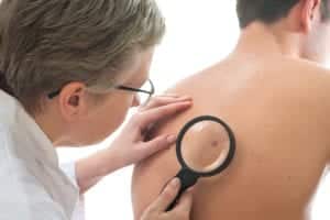 dermatologist checking skin